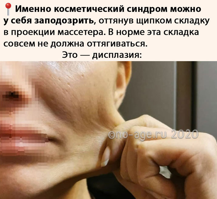 Дисплазия кожи на лице thumbnail